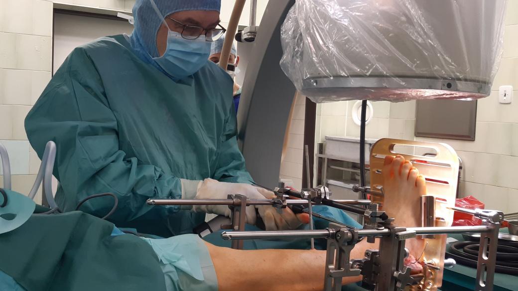Primář 1. Ortopedické kliniky Stanislav Popelka se pouští do totální endoprotézy kotníku