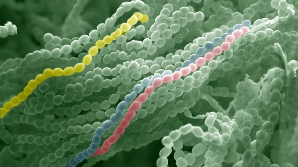 Plíseň štětičkovec Penicillium chrysogenum pod elektronovým mikroskopem